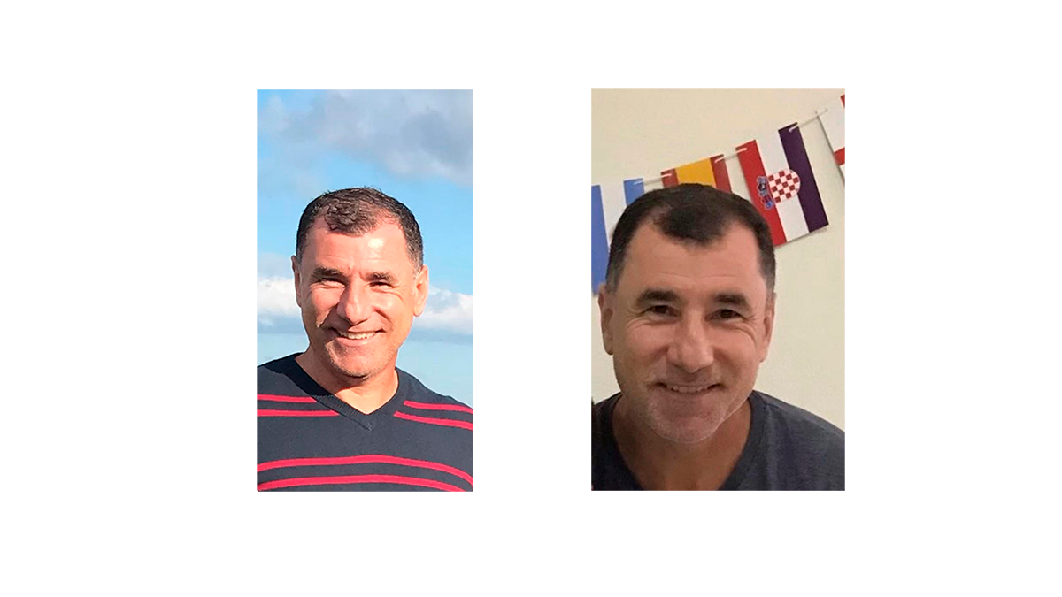 antes-depois-devanir